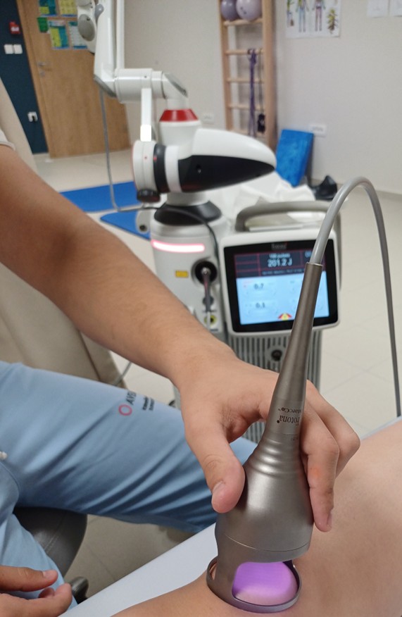 zdravljenje postherpetična nevralgija laser avelana otočec