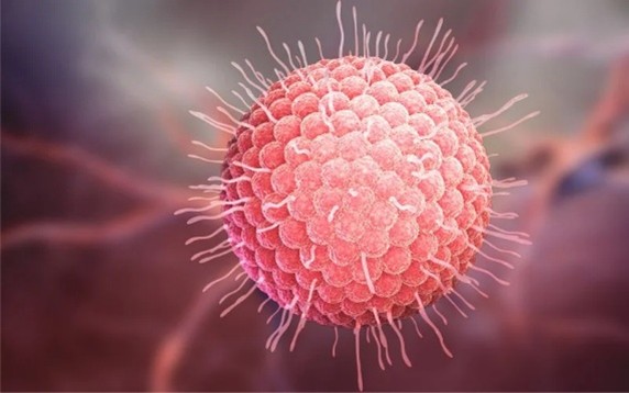 Lasersko zdravljenje pasovca (herpes zoster) | Avelana fizioterapija